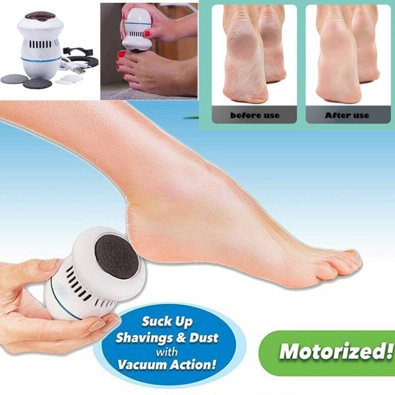 Electric Vacuum Callus Remover