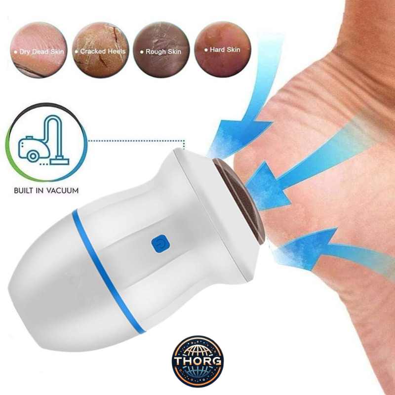 Electric Vacuum Callus Remover